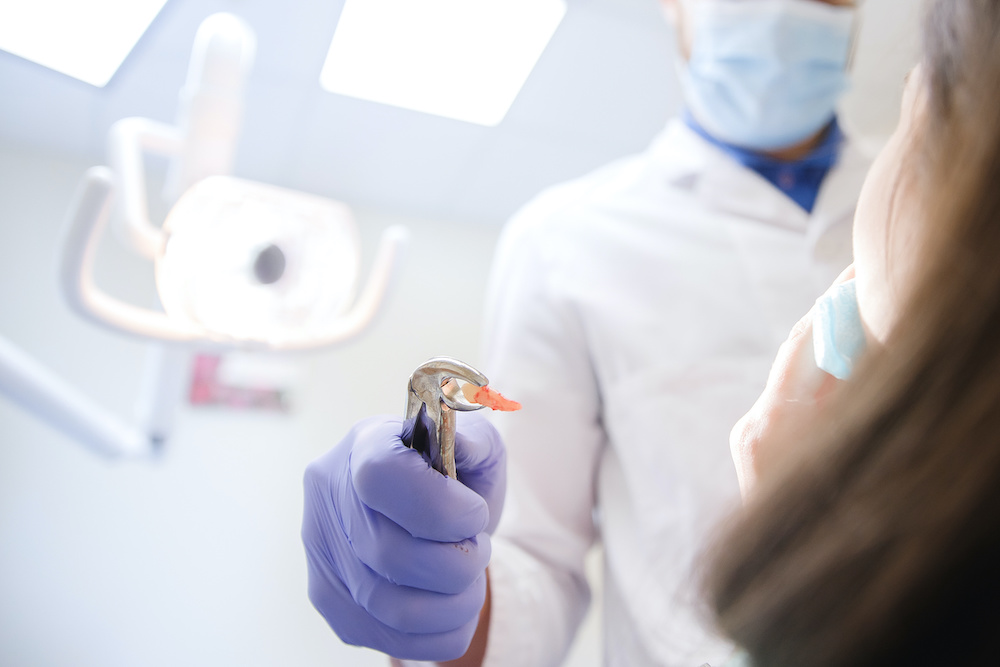 pediatric dental extraction